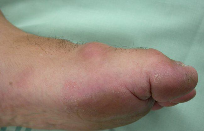 הלוקס ריגידוס הלוקס ריגידוס