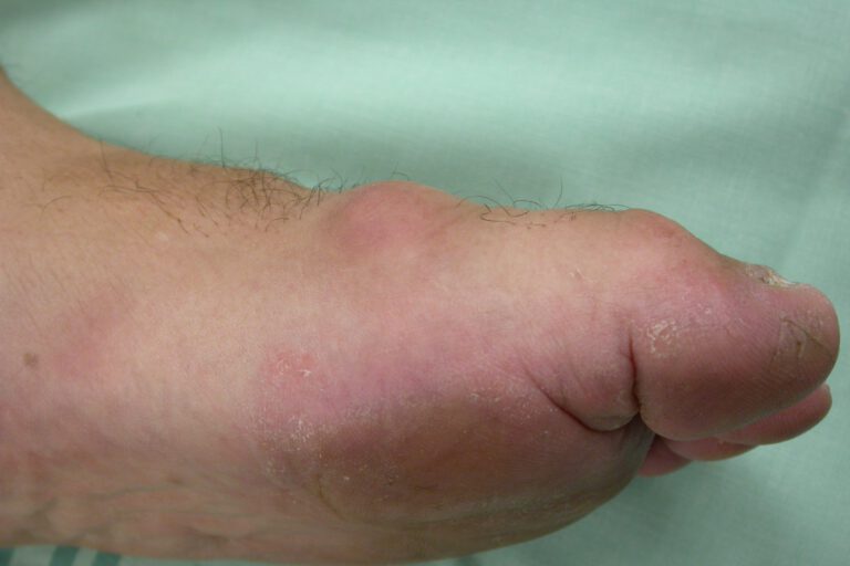 הלוקס ריגידוס