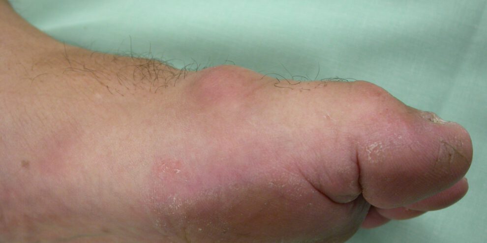 הלוקס ריגידוס